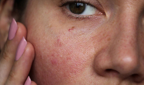 Sensitive Skin ke liye skincare routine kaise banaye
